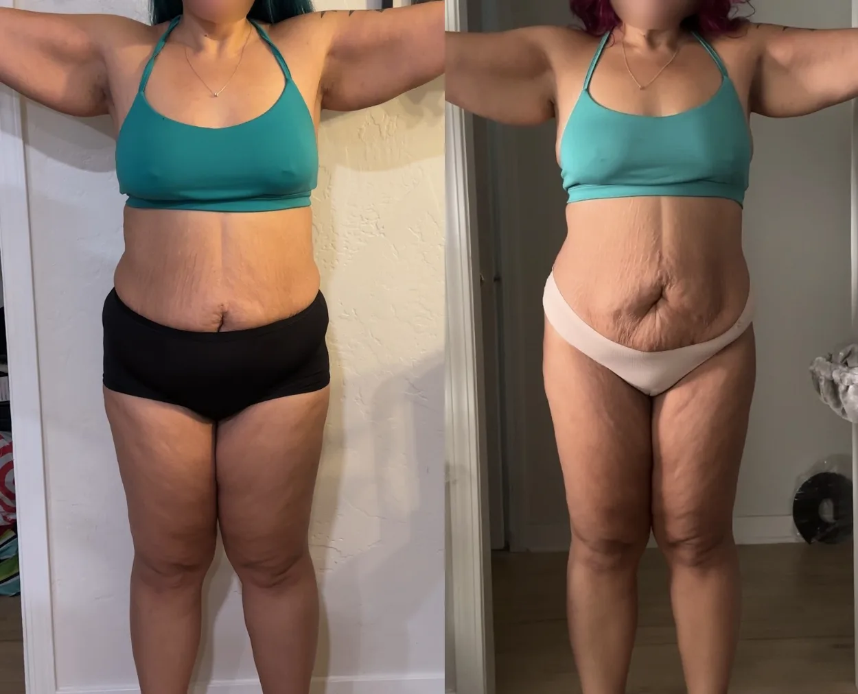 Before and after pictures of Jessica