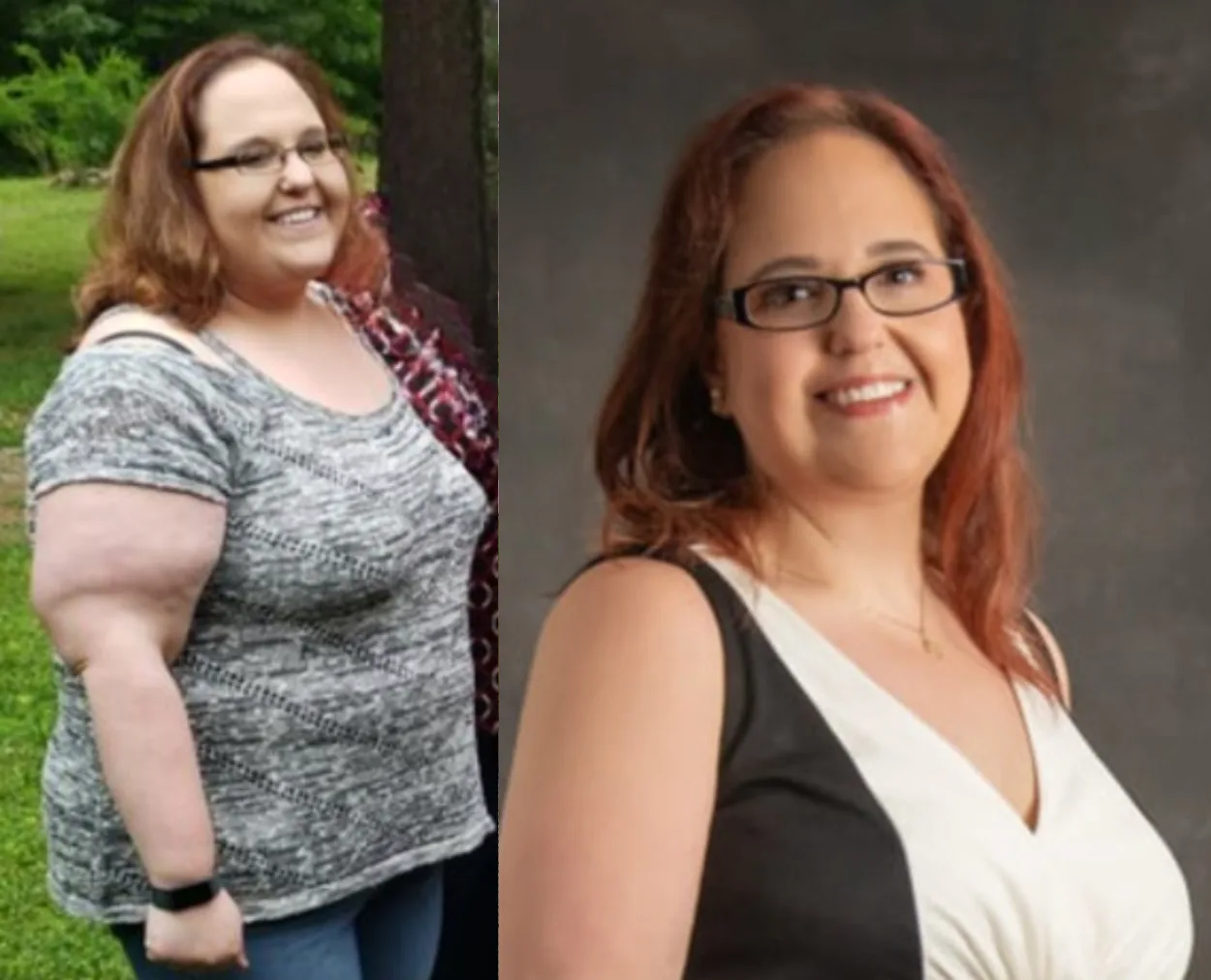 Before and after pictures of Kandice
